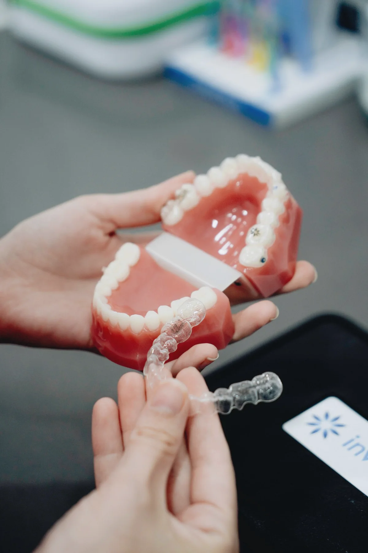 Clear dental aligner being fitted over a realistic upper-jaw model