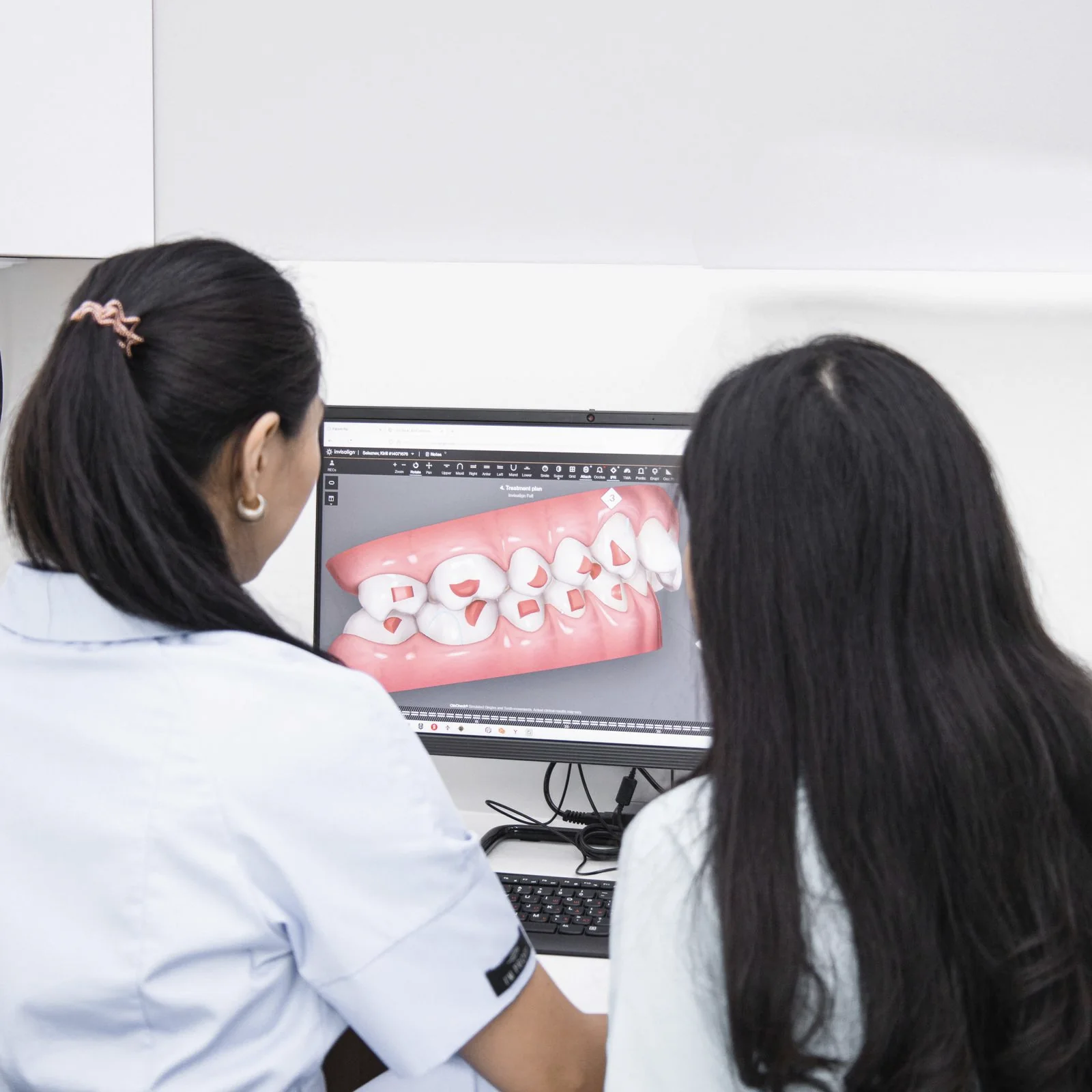 Clinicians reviewing a detailed digital dental restoration plan on screen